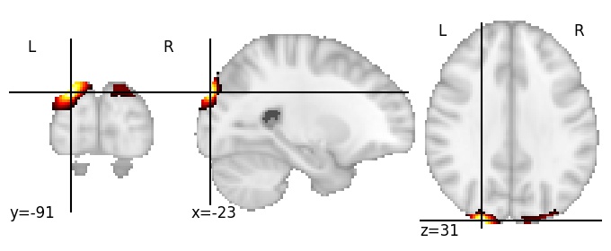 Component 695: Superior occipital gyrus posterior LH