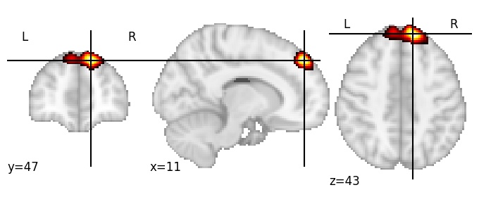 Component 699: Superior frontal gyrus anterior