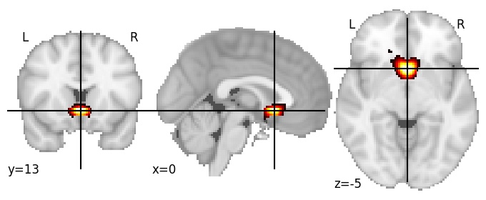 Component 717: Subcallosal cortex superior