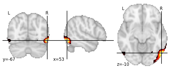 Component 724: Inferior occipital gyrus anterior RH