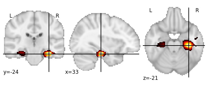 Component 726: Parahippocampal gyrus middle RH