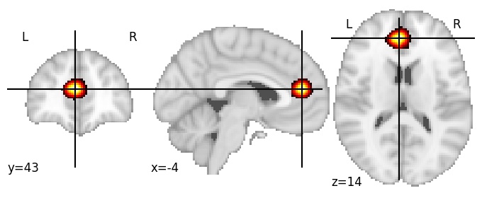 Component 741: Anterior cingulate cortex anterior LH