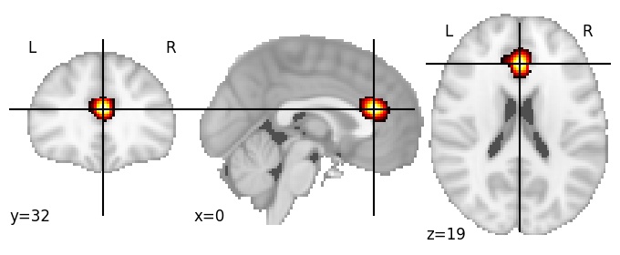 Component 758: Anterior cingulate cortex