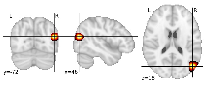 Component 763: Lateral occipital cortex middle RH