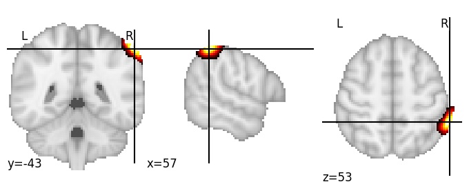 Component 764: Angular gyrus antero-superior RH