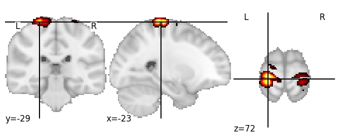 Component 767: Superior parts of central and postcentral gyrus