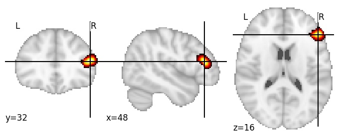 Component 773: Inferior frontal sulcus middle RH