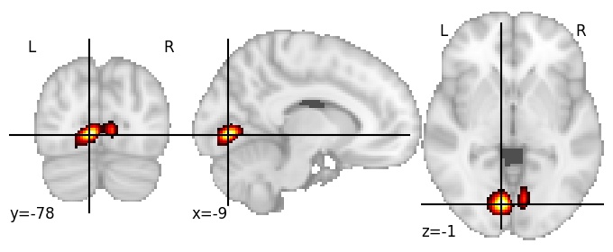 Component 780: Lingual gyrus middle