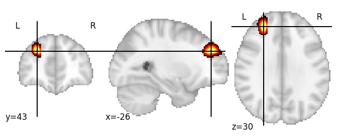 Component 788: Middle frontal sulcus middle LH