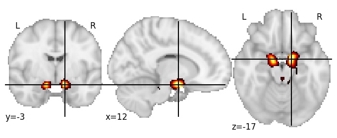 Component 9: Parahippocampal gyrus anterior
