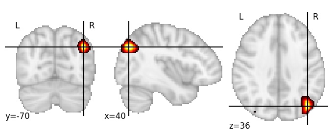 Component 863: Lateral occipital cortex mid-superior RH