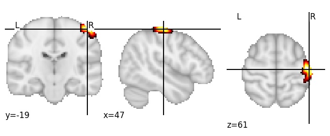 Component 868: Middle parts of postcentral gyrus and precentral gyrus RH