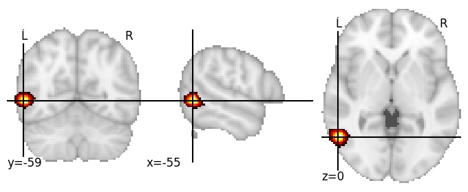 Component 885: Middle temporal gyrus posterior inferior LH