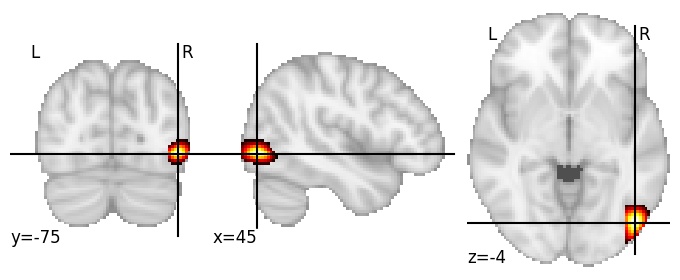 Component 91: Lateral occipital cortex antero-inferior RH