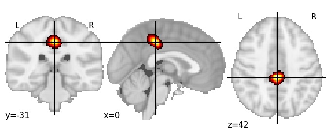 Component 902: Cingulate gyrus mid-posterior