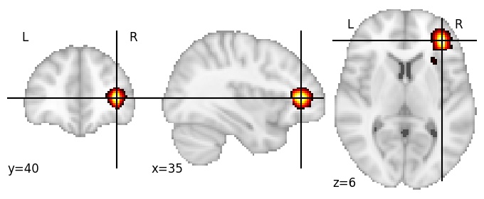 Component 924: Inferior frontal gyrus mid-anterior RH