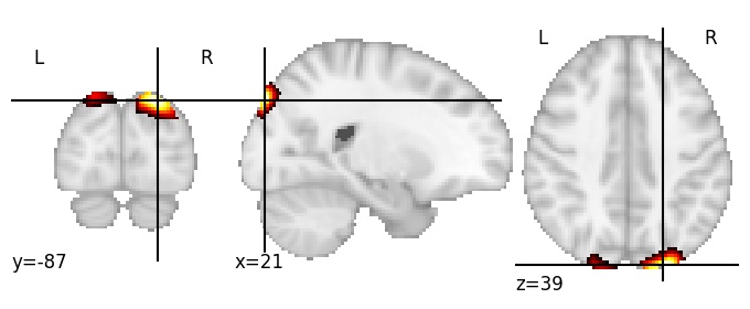 Component 927: Superior occipital gyrus mid-superior