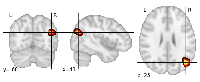 Component 97: Lateral occipital cortex mid-anterior RH