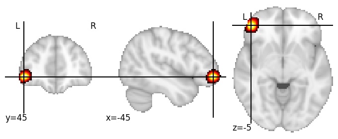 Component 980: Inferior frontal gyrus anterior LH