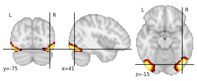 Component 108: Inferior occipital gyrus