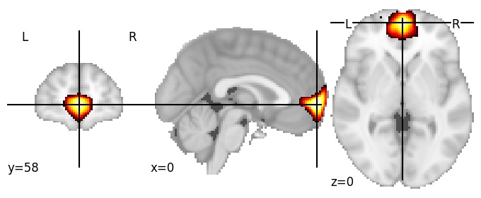 Component 117: Ventromedial prefrontal cortex anterior
