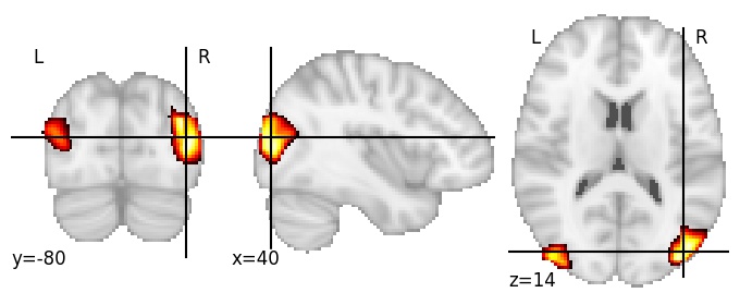 Component 13: Lateral occipital cortex superior