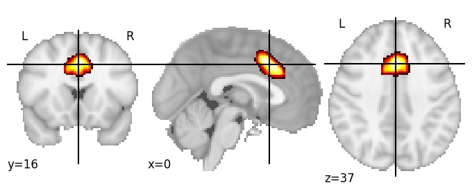 Component 19: Cingulate cortex mid-anterior