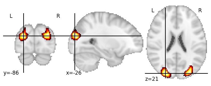 Component 3: Superior occipital gyrus