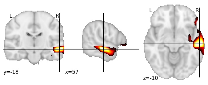 Component 26: Middle temporal gyrus RH
