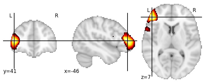 Component 32: Inferior frontal gyrus anterior, LH