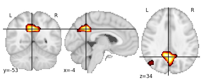 Component 33: Posterior cingulate cortex