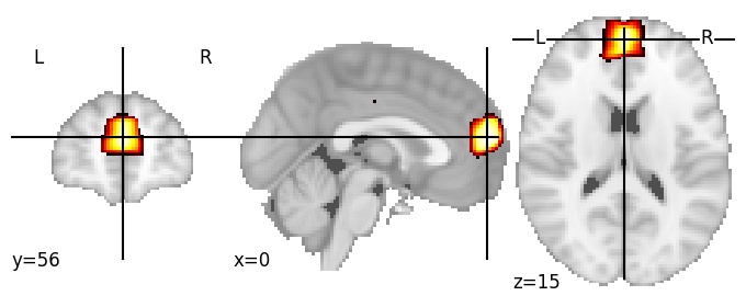 Component 35: Dorsomedial prefrontal cortex antero-superior