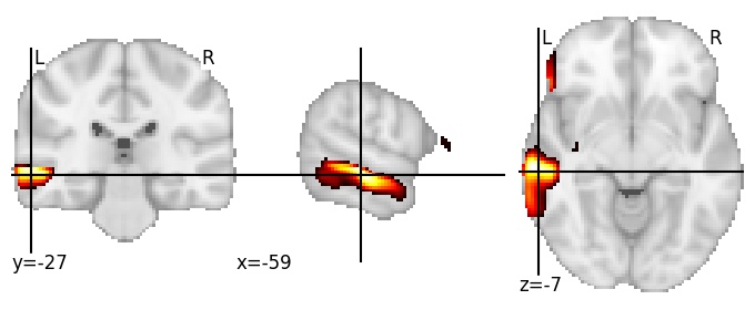 Component 42: Middle temporal gyrus LH