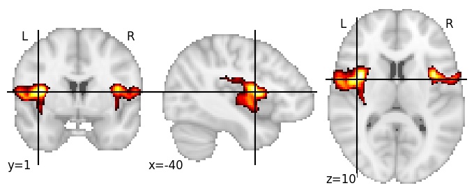 Component 49: Insula center and lateral fissure
