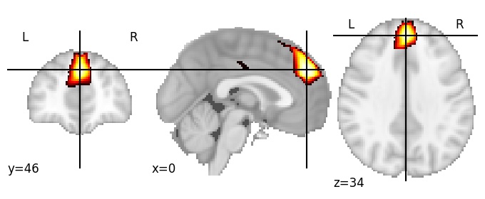 Component 58: Dorsomedial prefrontal cortex anteromedial