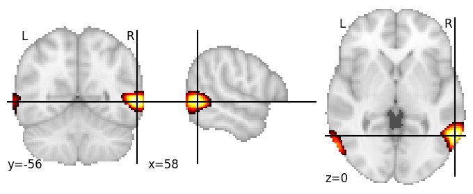 Component 108: Middle temporal gyrus posterior