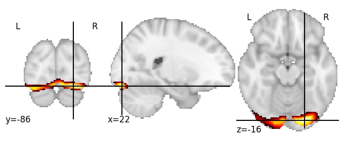 Component 112: Inferior occipital gyrus posterior