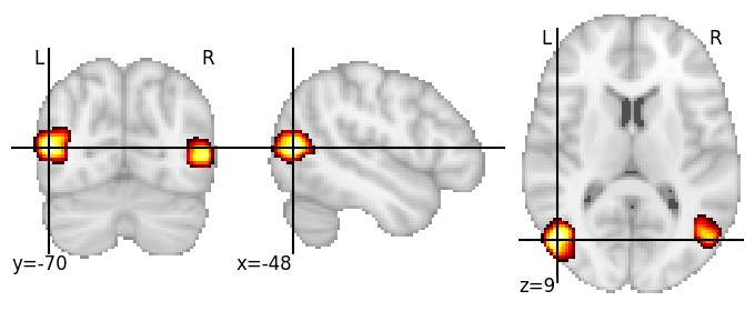 Component 113: Lateral occipital cortex anterior