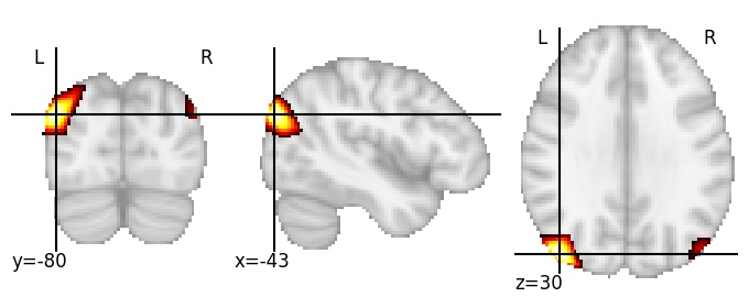 Component 120: Lateral occipital cortex superior