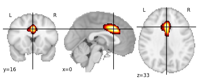 Component 13: Cingulate cortex mid-anterior