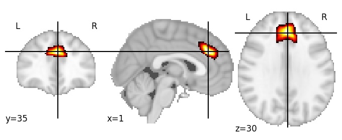 Component 121: Dorsomedial prefrontal cortex