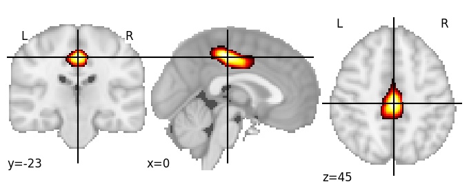 Component 14: Cingulate cortex mid-posterior