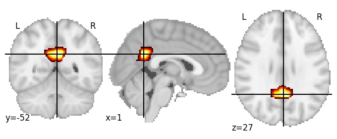 Component 15: Posterior cingulate cortex posterior