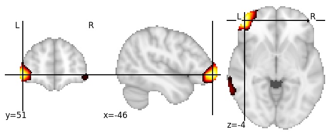 Component 141: Inferior frontal gyrus anterior LH