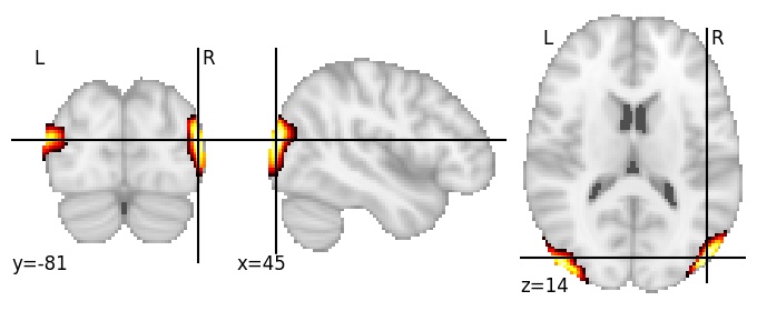 Component 194: Lateral occipital cortex