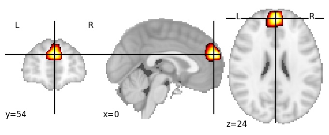 Component 235: Dorsomedial prefrontal cortex anterior