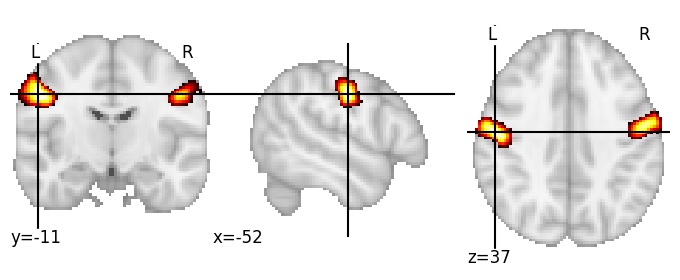 Component 239: Precentral gyrus middle
