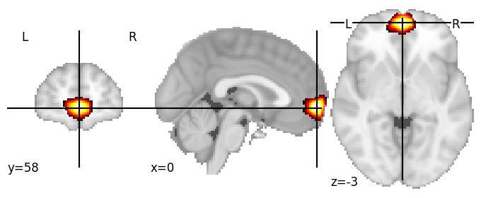 Component 244: Ventromedial prefrontal cortex anterior