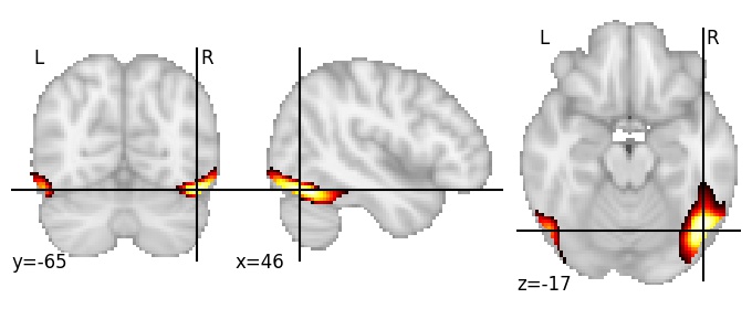 Component 28: Inferior occipital gyrus