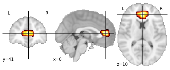 Component 32: Anterior cingulate cortex middle
